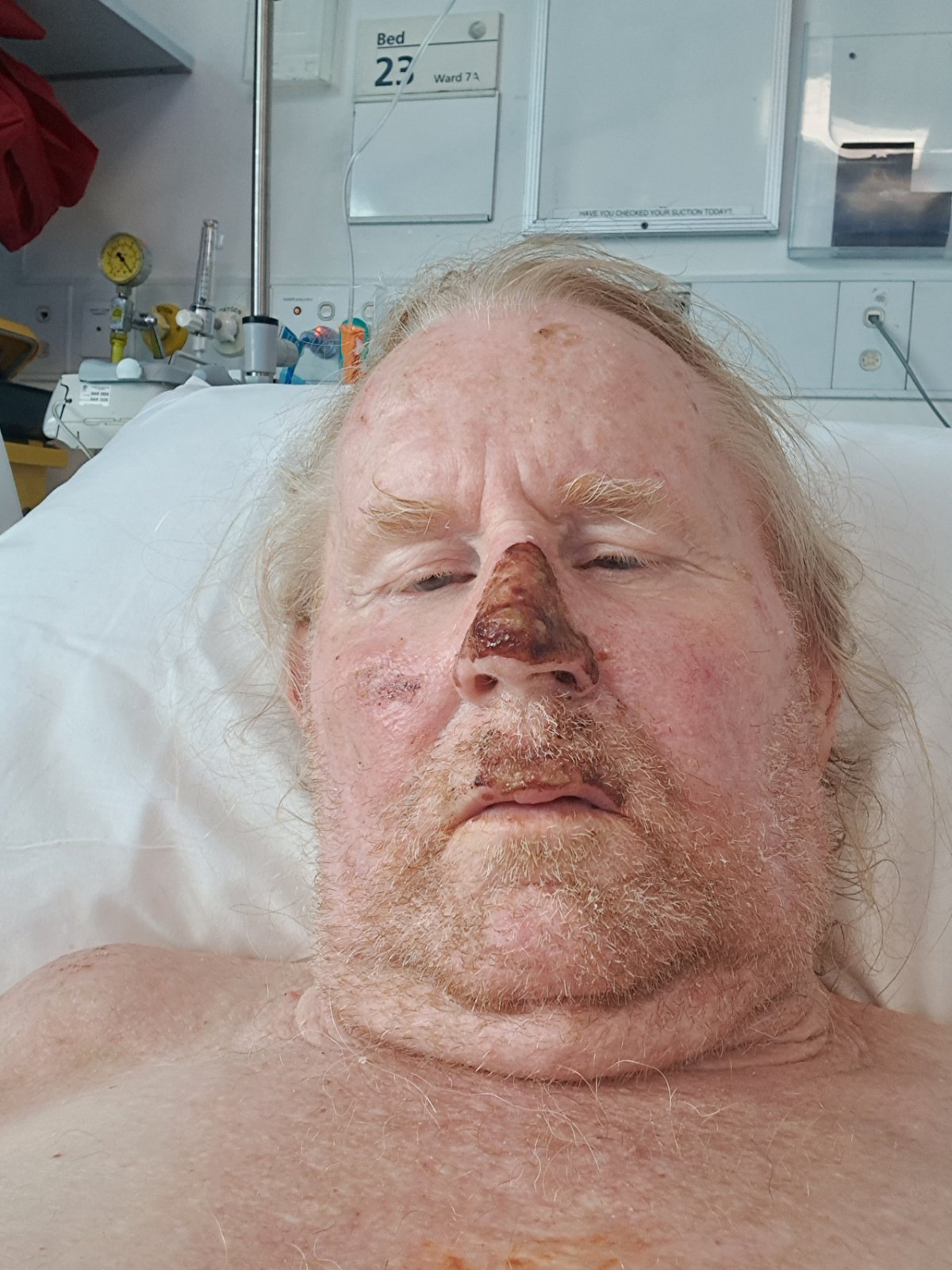 Ash is in hospital