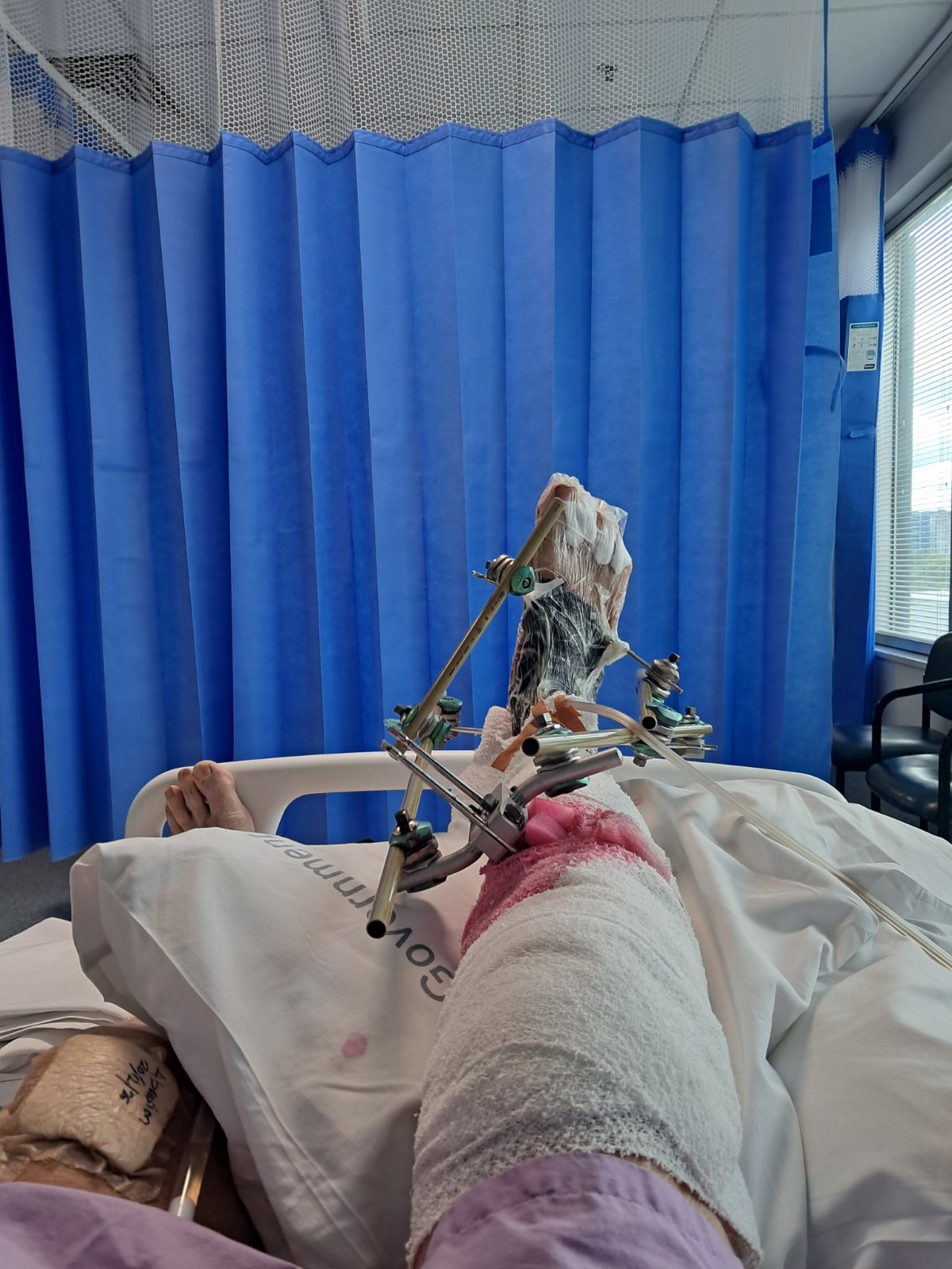 Ash is in hospital