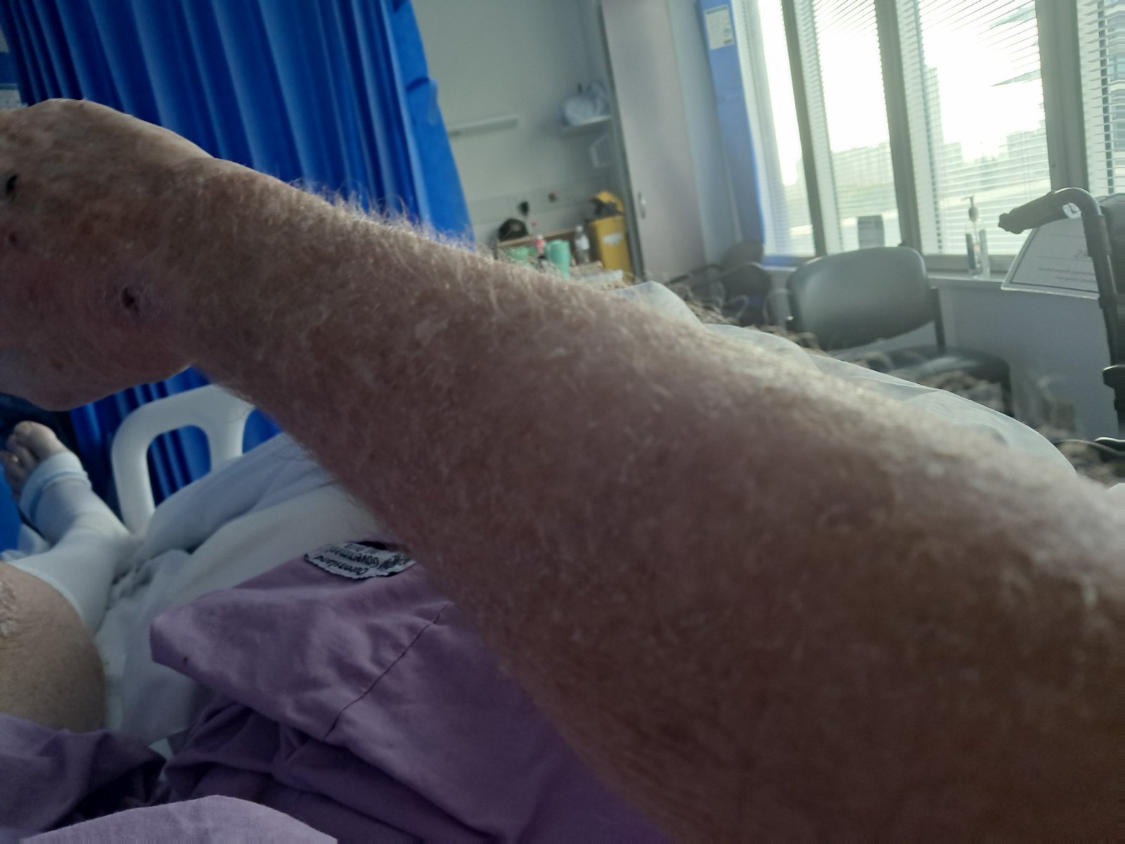 Ash is in hospital