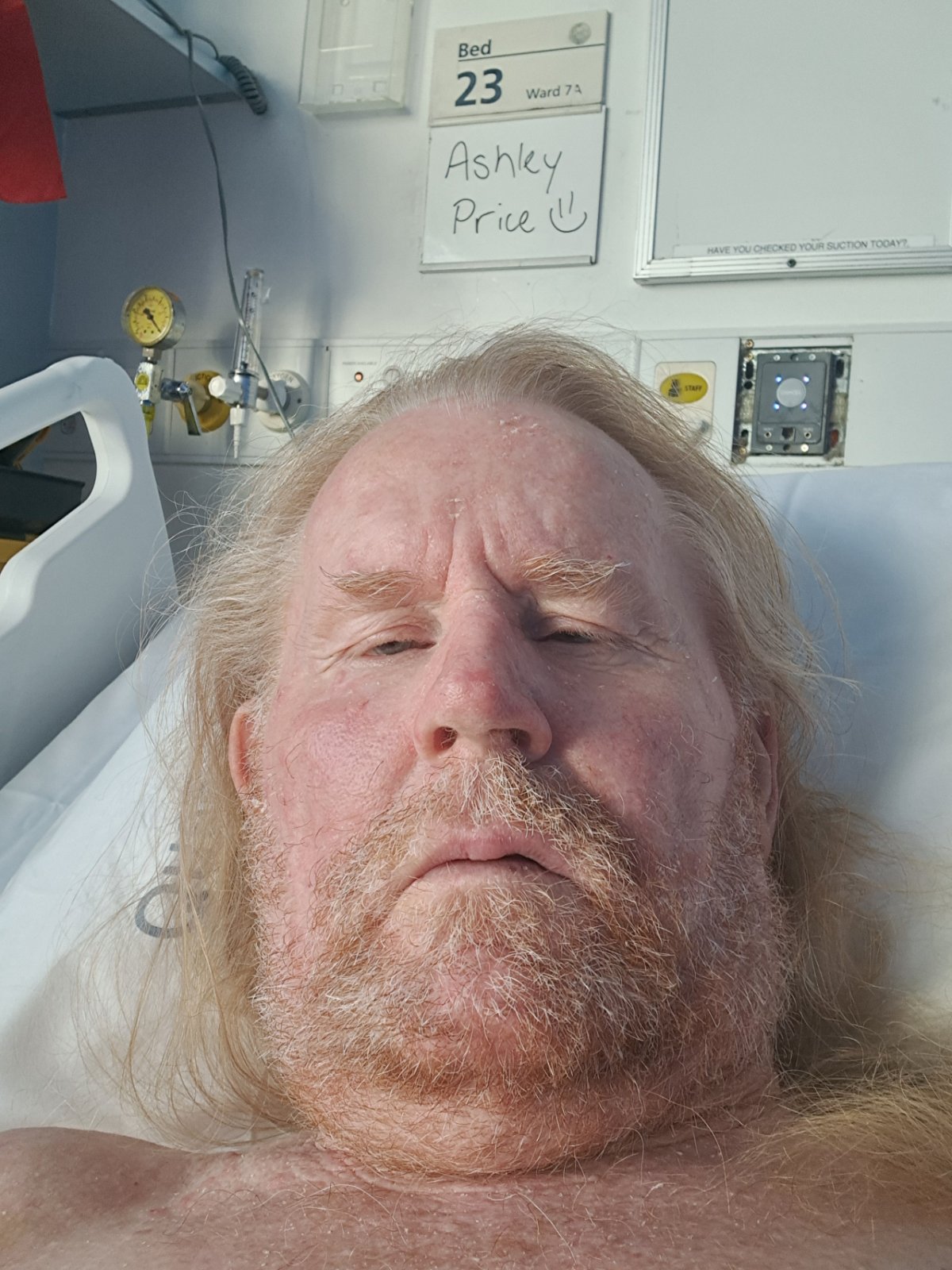 Ash is in hospital