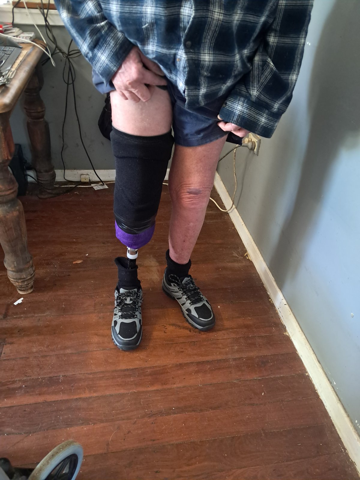 Ash is in hospital