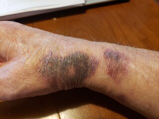 What Did You Do With Your Commando Today?