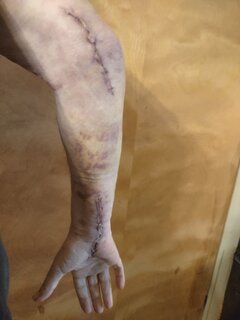 What Did You Do With Your Commando Today?